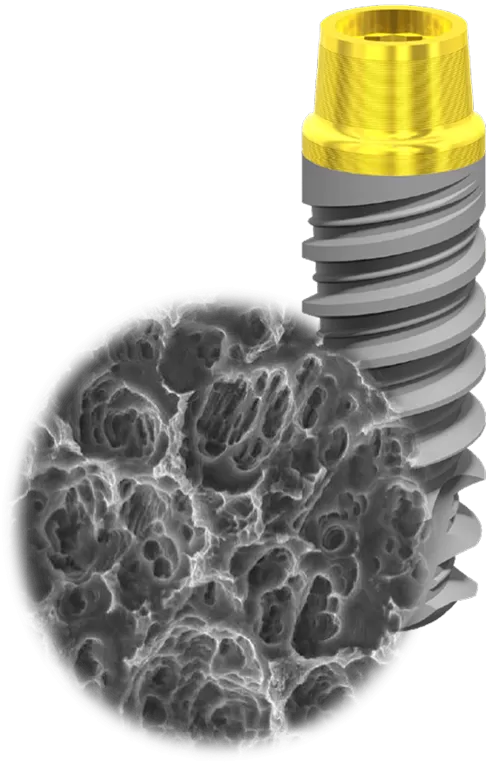 Newton kit bone bender