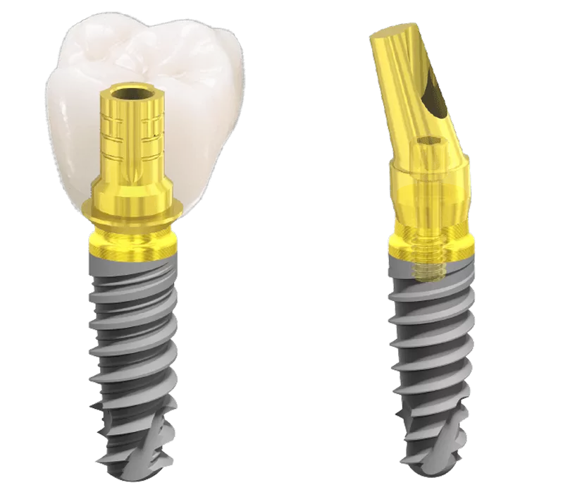 Newton connessione dell'impianto