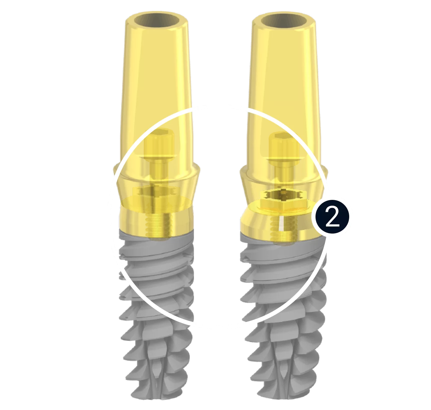 Newton X &egrave; un sistema implantare brevettato